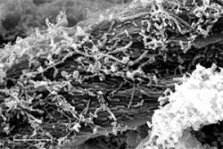 Electron micrograph of microbes from a landfill site colonising and degrading cellulose.