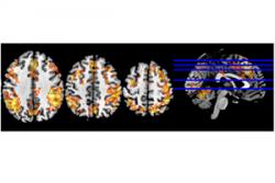 Esiampl o’r canlyniadau fMRI sy’n cael eu dal a’u dadansoddi